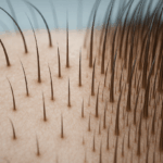 The FDA-Approved Frequency for Hair Regrowth That Doctors Don’t Want You to Know
