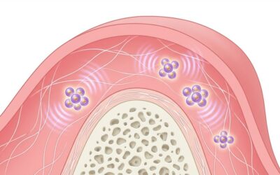 Dentists Don’t Want You to Know: The $15,000 Gum Surgery Secret That Frequency Therapy Replaces for $0