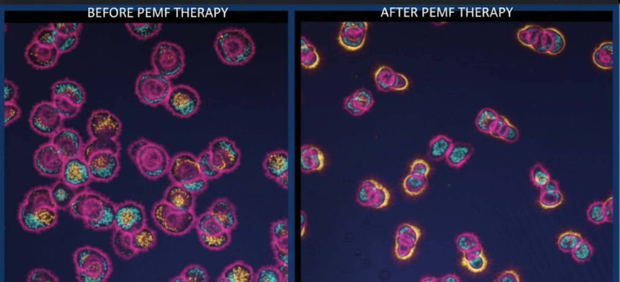 Before and After PEMF Therapy - Cellular Coherence Visualization