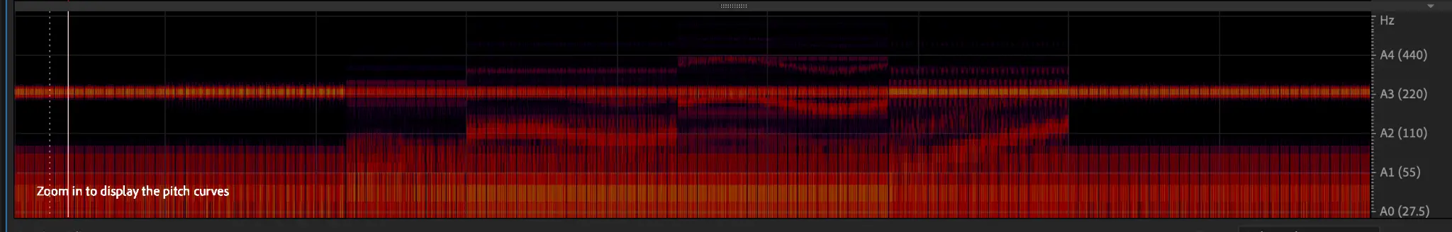 Trigeminal nerve spectral analysis waveform 1