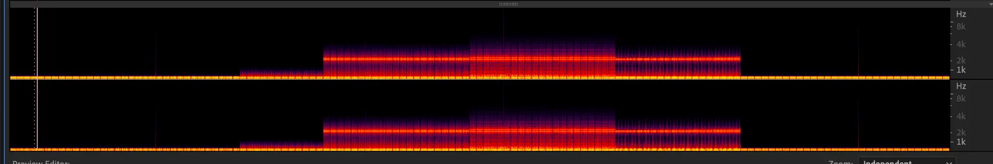 Trigeminal nerve spectral analysis waveform 2