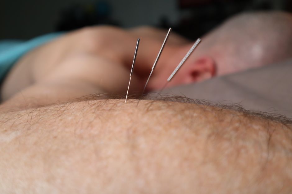 Bioelectric Field Therapy: Advanced Healing